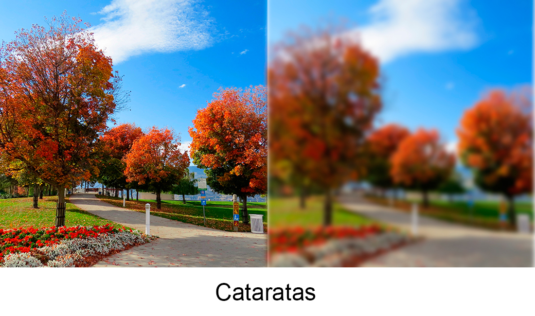 Cataratas_bv